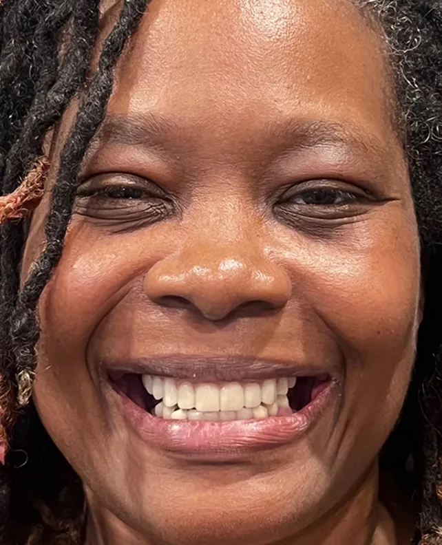 Patient 3 smile after dental implants