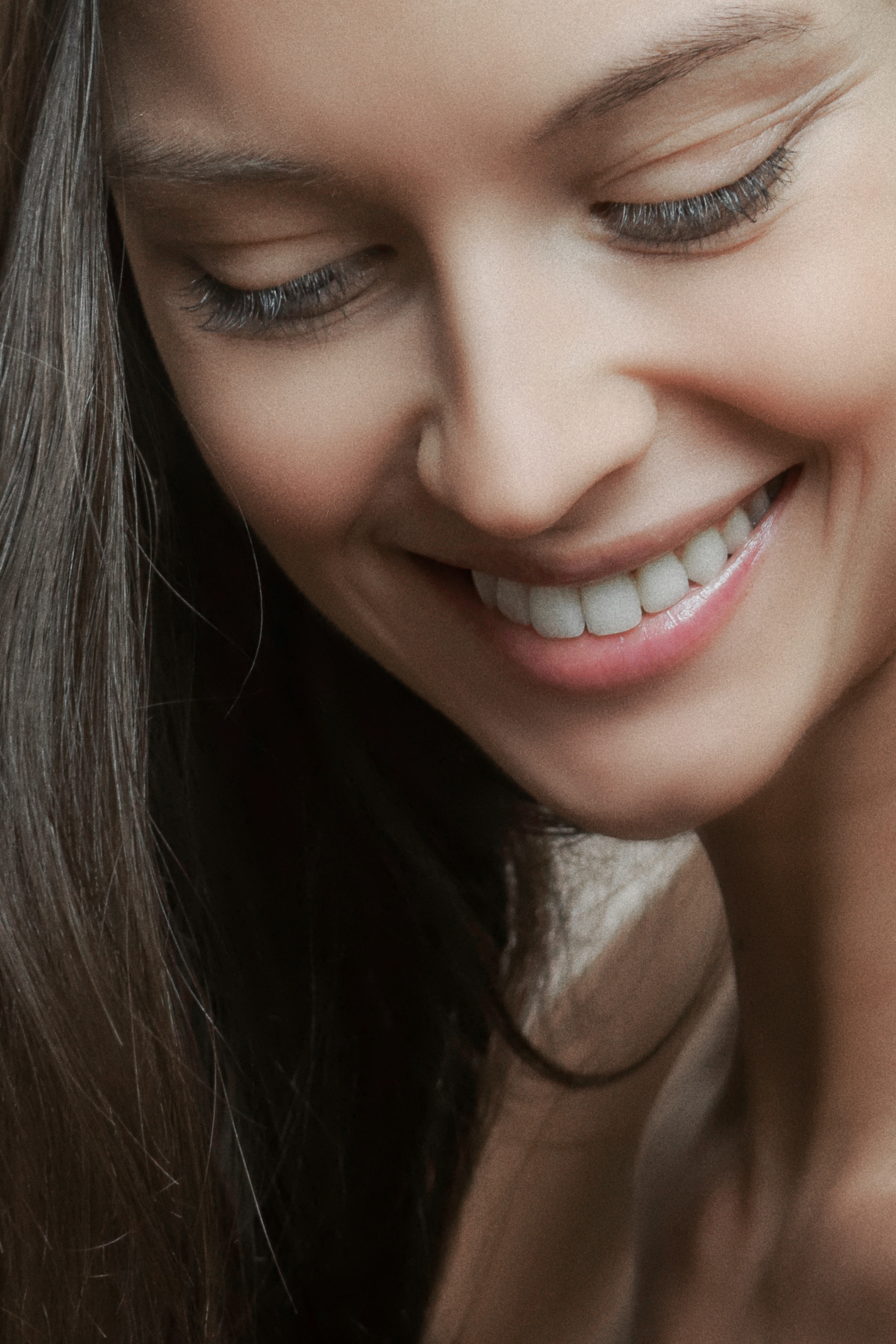 Common Myths and Misconceptions About Dental Veneers